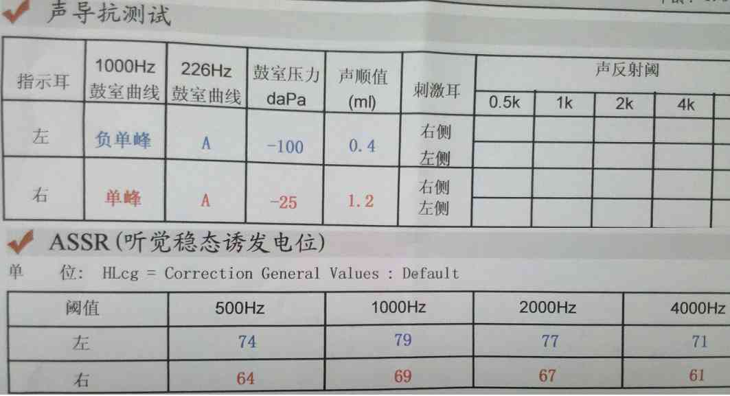 听力检测报告术语解读：全面解析各项字母代表的含义及意义