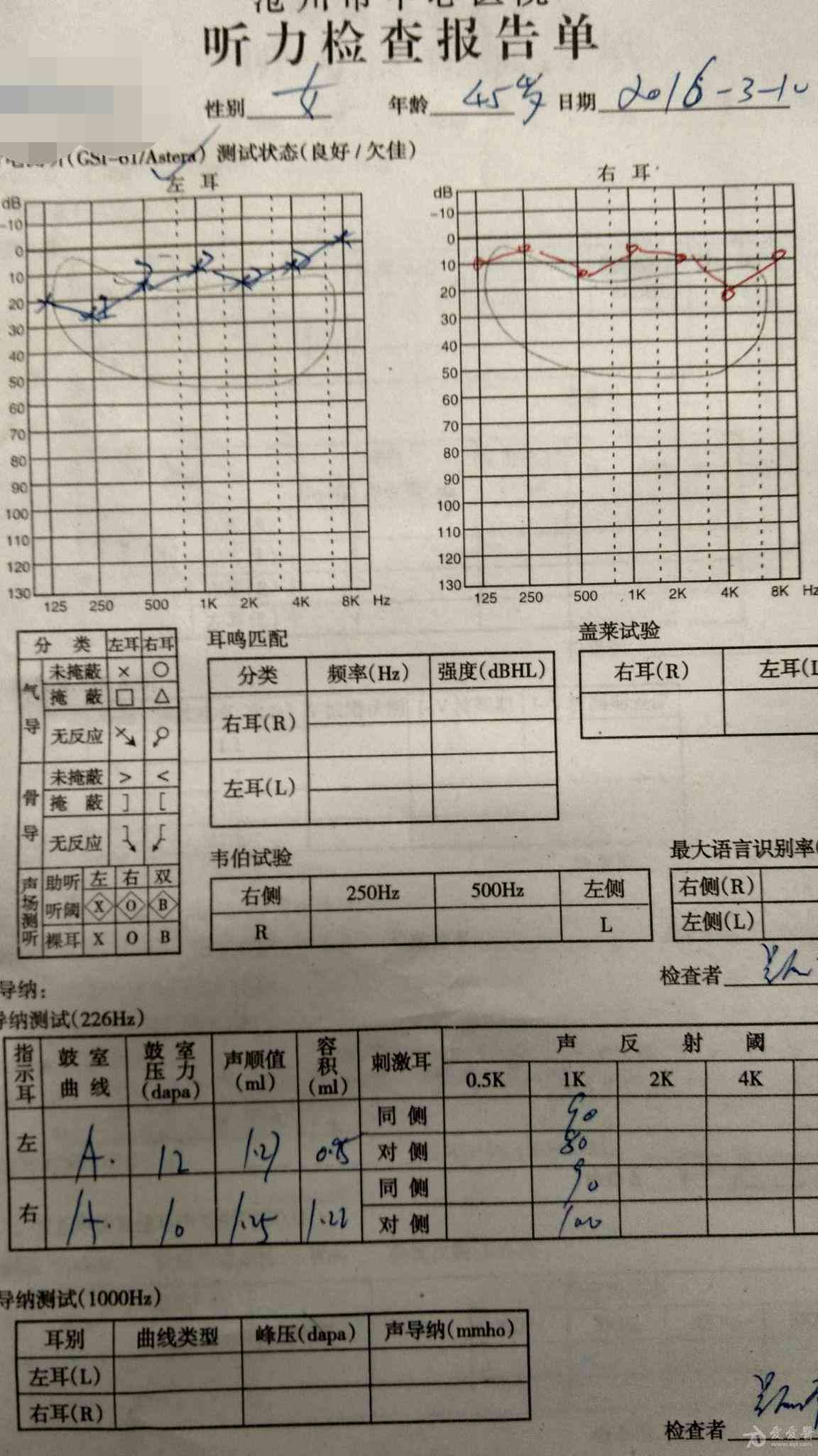 听力检测报告单AI数值为0
