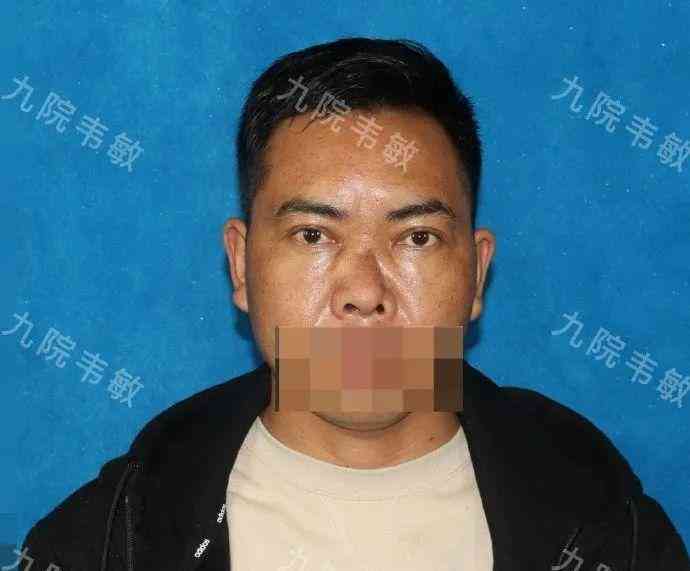 工伤认定解析：头外伤在何种情况下可被判定为工伤事故及所需证据材料