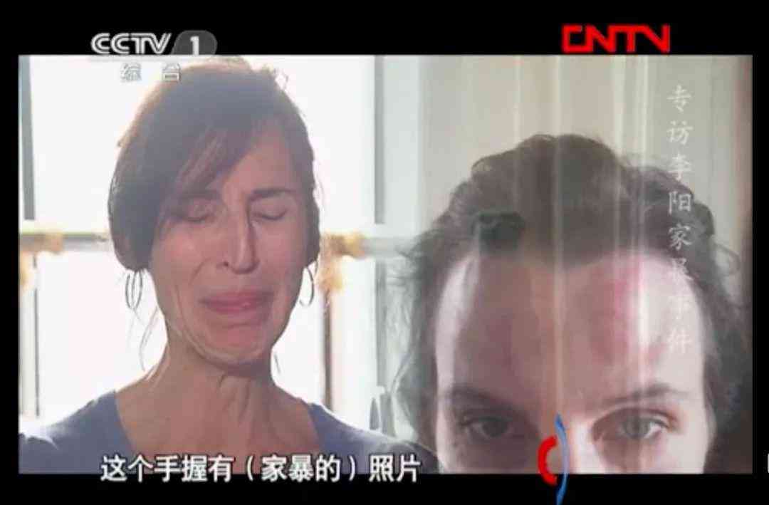 工伤导致的头部挫伤认定与赔偿指南：包含鉴定标准、赔偿流程及具体项目解析
