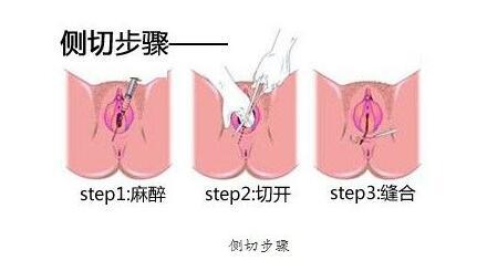 头皮撕裂算重伤不算轻伤，有后遗症吗？