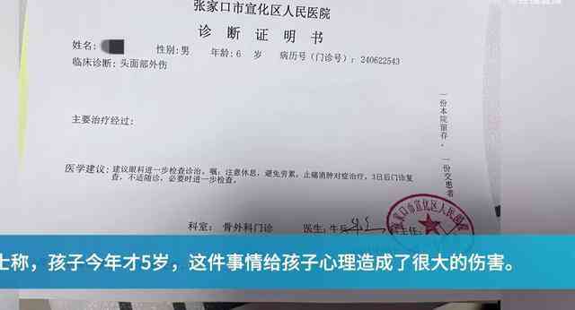 女人52周岁还能评工伤，50岁以上女性能否进行工伤认定？