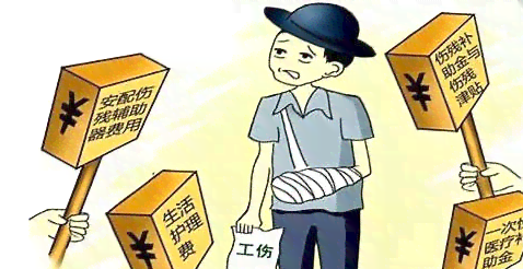 五十岁以上女性工伤认定标准探讨：年龄是否影响工伤认定