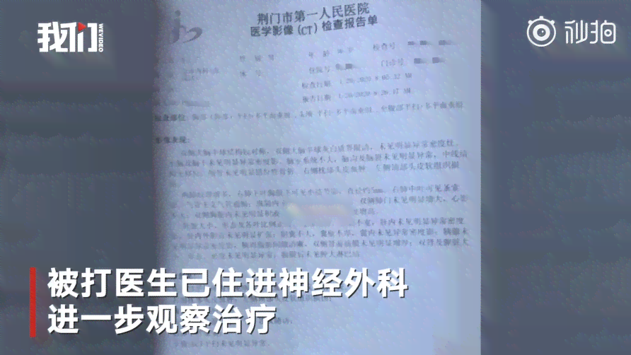 52岁女性工伤事故认定标准及年龄限制详解