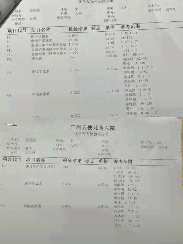 53岁女性工伤认定标准详解：年龄是否影响工伤判定