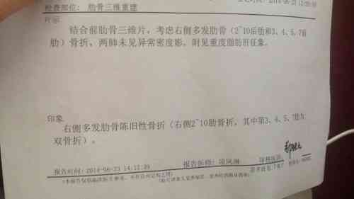 探讨女性50岁以上工伤认定及伤残等级评定标准与条件