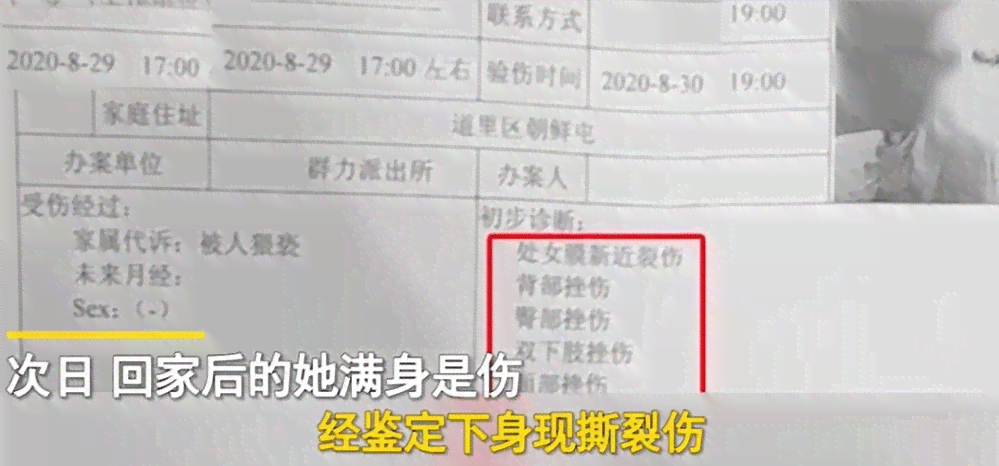 女的几岁认定工伤残疾等级
