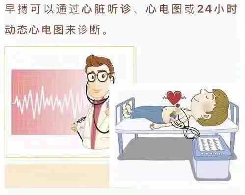室性早搏是否属于重大疾病？探讨其医疗报销及治疗要点