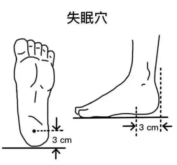 小指肌腱断裂工伤等级认定指南：损伤程度、评定标准与申请流程解析