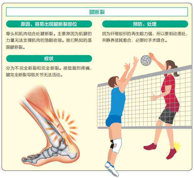 深入了解小腿挫伤：运动损伤解析与复指南