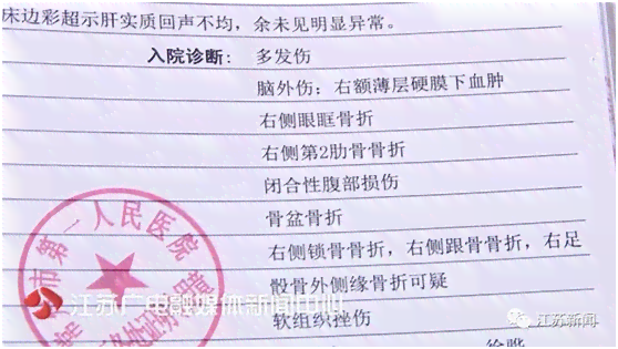 小腿缝合6针是否构成轻伤：法律标准与医疗鉴定解析