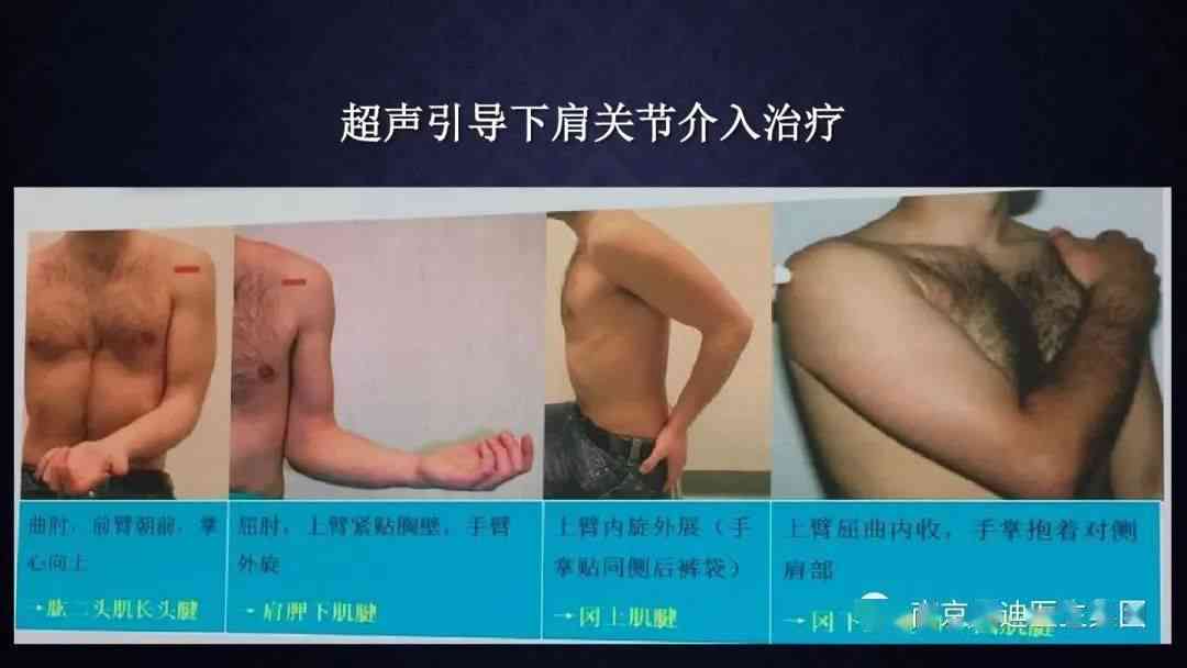 小腿缝合6针是否构成轻伤：法律标准与医疗鉴定解析