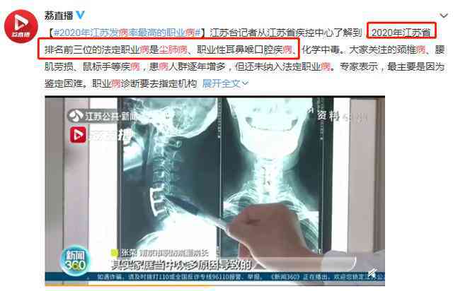 工伤尘肺认定后复发，新增矽肺病状如何处理》