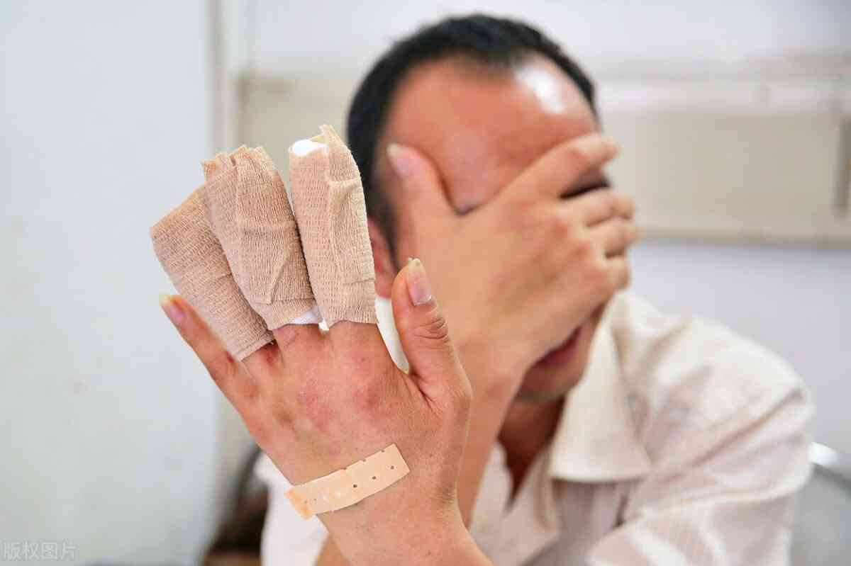 尿症怎样能认定工伤伤残
