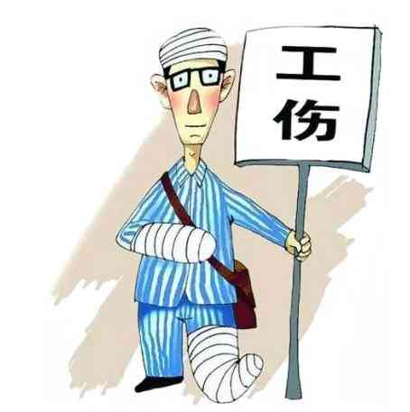 工人自己受伤需要承担责任吗：工人受伤责任及承担比例合法性探讨