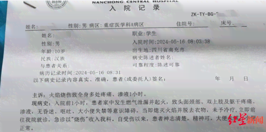 工作一天受伤赔偿哪些：误工费计算与赔偿标准