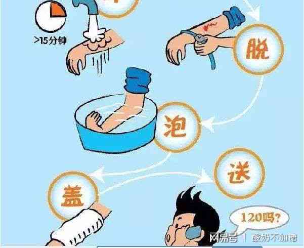 工作中遭遇烫伤事故：原因分析、处理方法及预防措