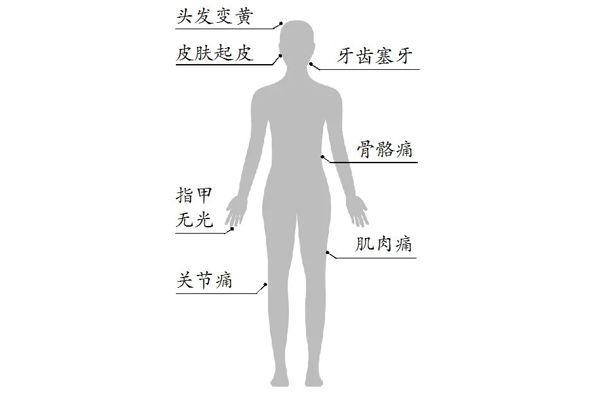 工作过度疲劳的十大症状及具体表现