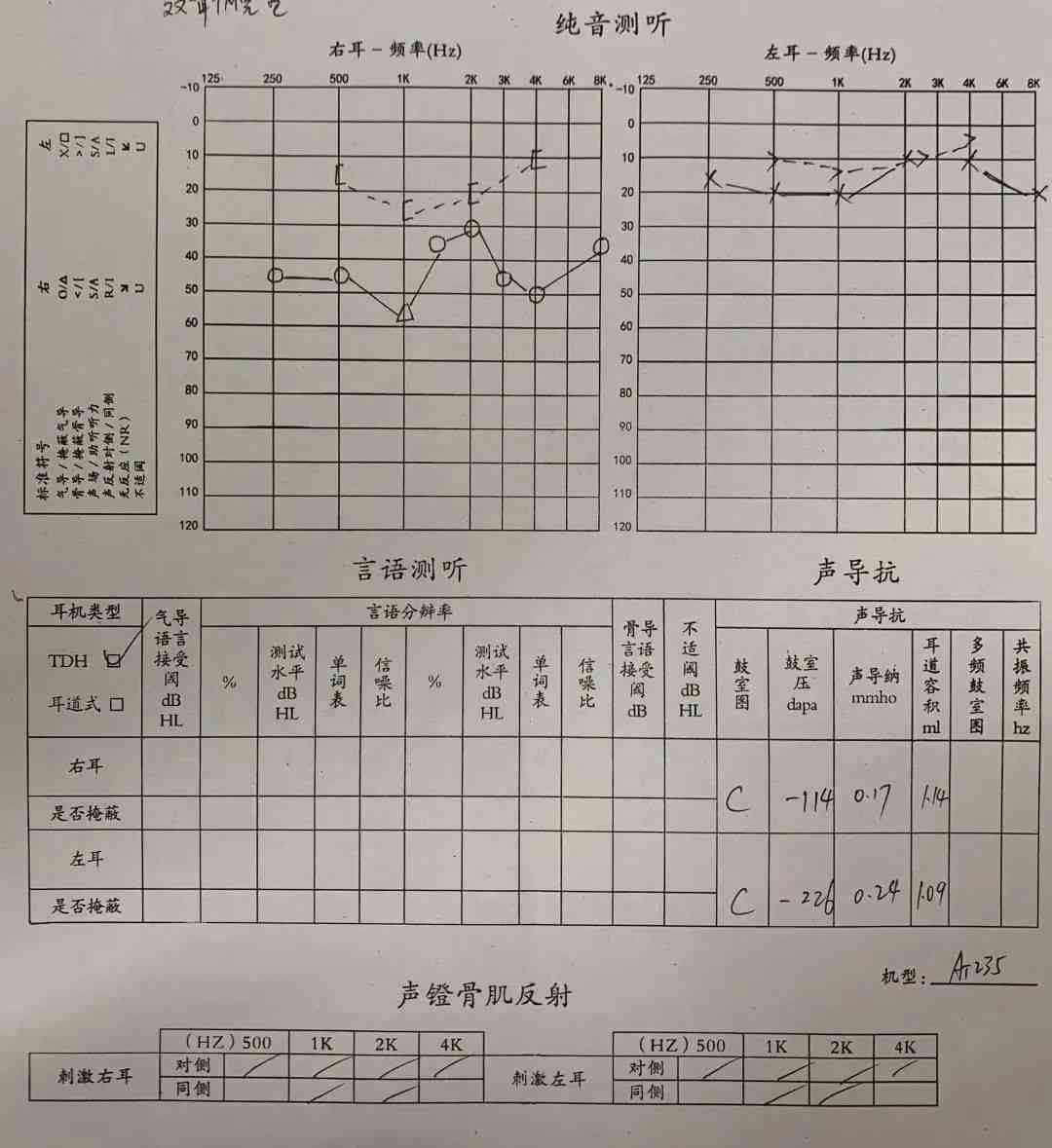 正常的电测听报告单：填写方法、结果计算及样本示例