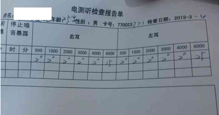 正常的电测听报告单：填写方法、结果计算及样本示例