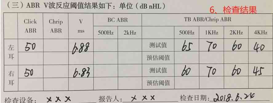 正常的电测听报告单：填写方法、结果计算及样本示例