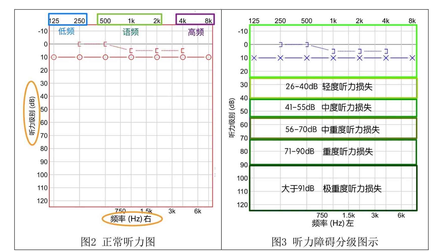 掌握听力健状况：深度解读电测听报告单指南