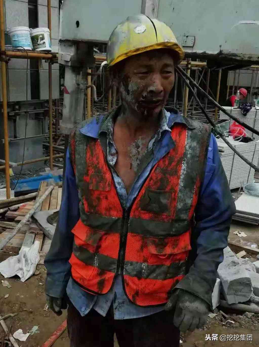 工地劳动受伤误工赔偿标准详解及补偿计算方法