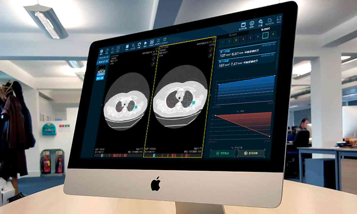 AI辅助撰写年总结报告：全方位攻略与实用技巧解析