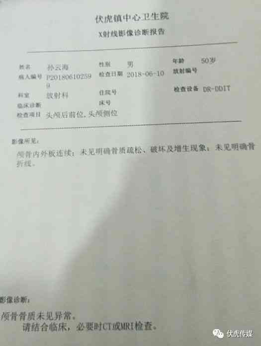 工地高空坠物怎么认定工伤赔偿及处罚标准与金额