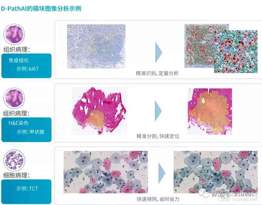 '滇南医疗AI辅助病理报告在线查询平台'