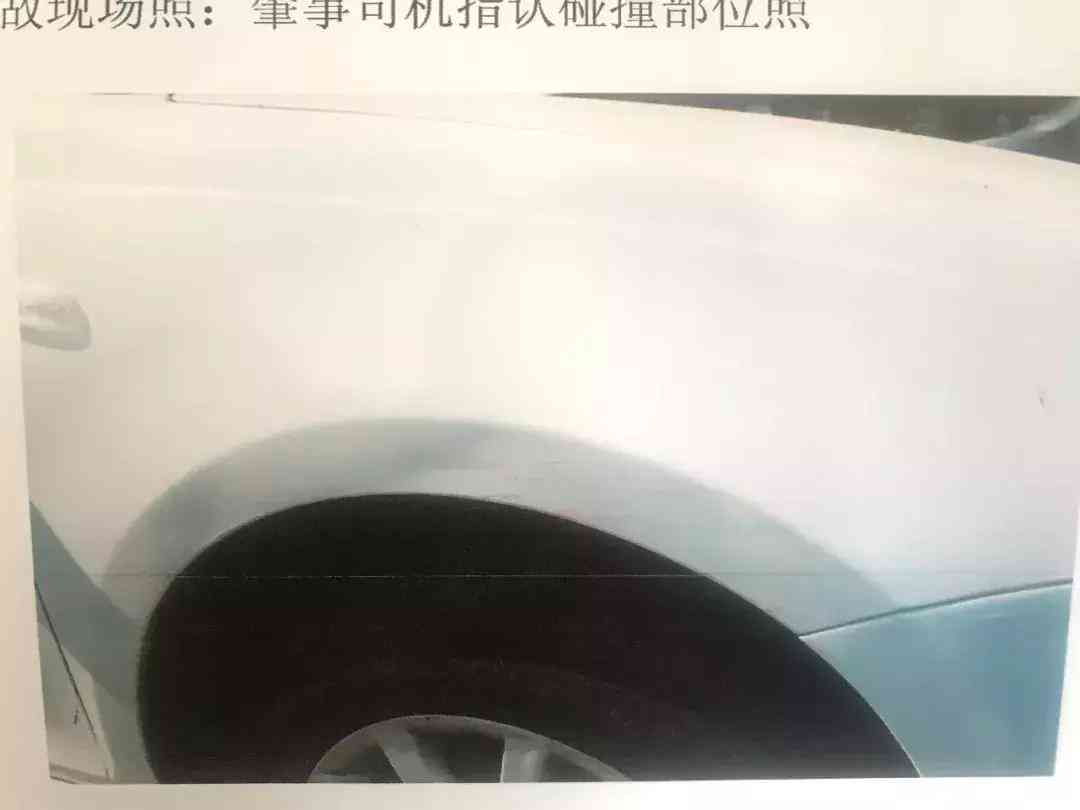 足挫伤原因、症状与治疗方法详解——全方位解析足部挫伤问题