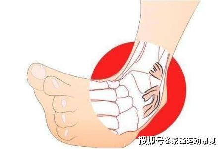 踝扭伤多久才能恢复：正常走路与活动恢复时间解析