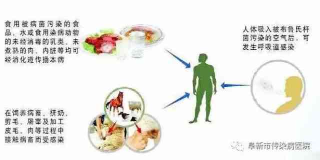 布氏菌病赔偿新规：详述病患赔偿标准与流程