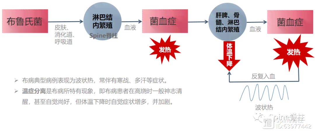 布氏菌病赔偿新规：详述病患赔偿标准与流程