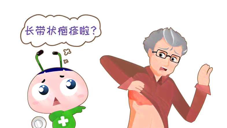 水土不服引发的带状疱疹，能否认定为工伤？