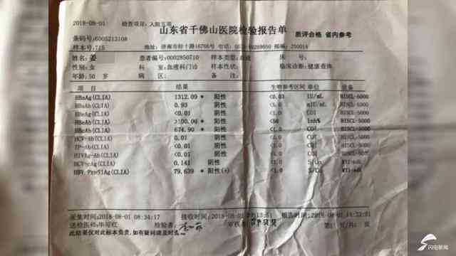 带状疱疹影响入职吗：入职体检、公务员体检、征兵体检及正常工作受影响吗？