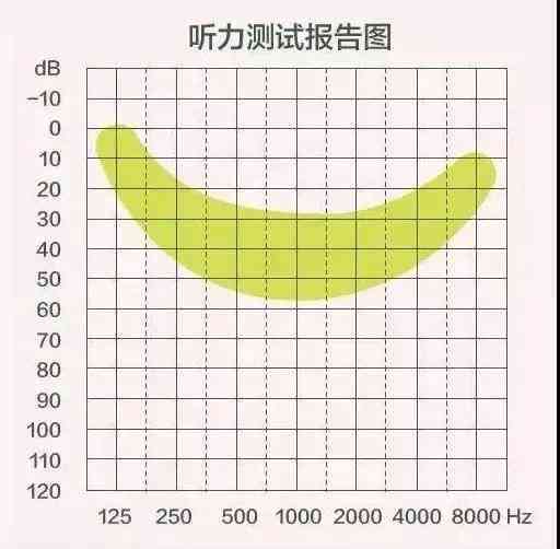 纯音听力检测标准正常参考值解析