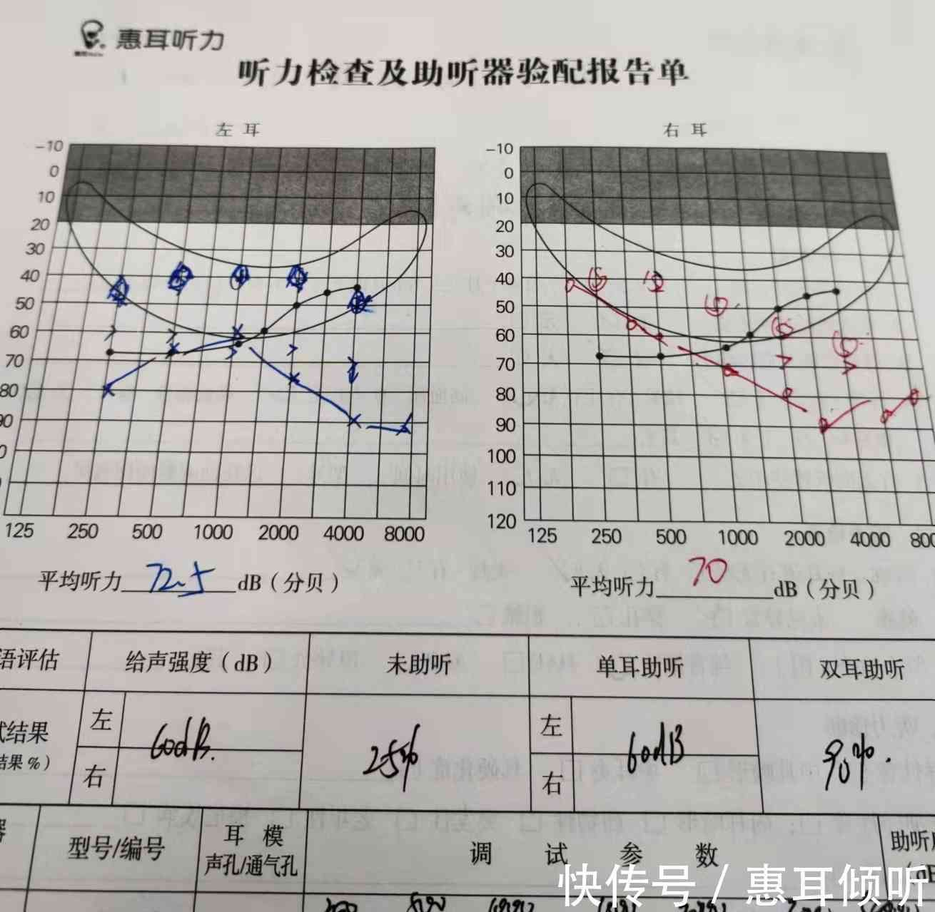 听力健评估：纯音听阈检测综合报告