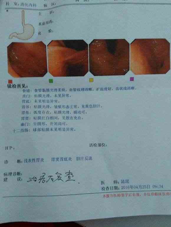 胃镜报告AI期什么意思：AB 与AB区别及S期解析