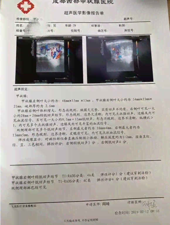 胃镜报告AI期什么意思：AB 与AB区别及S期解析