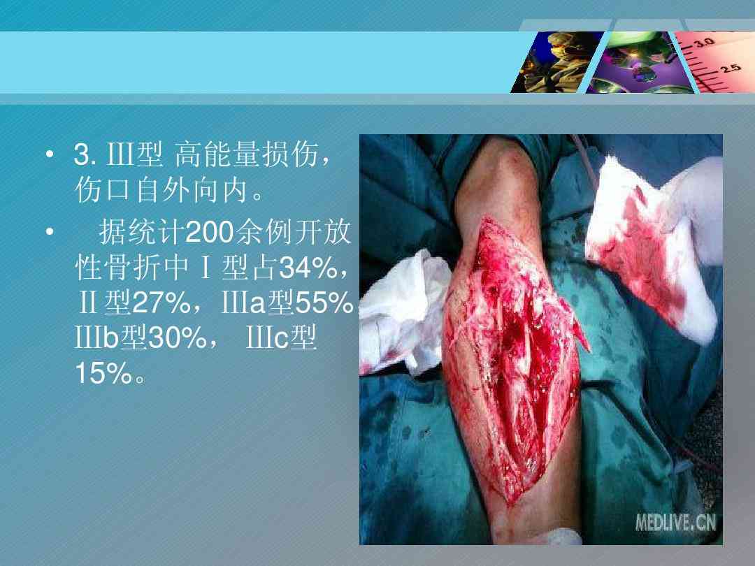 深度解析：开放性损伤的三大分类及其特点与处理方法