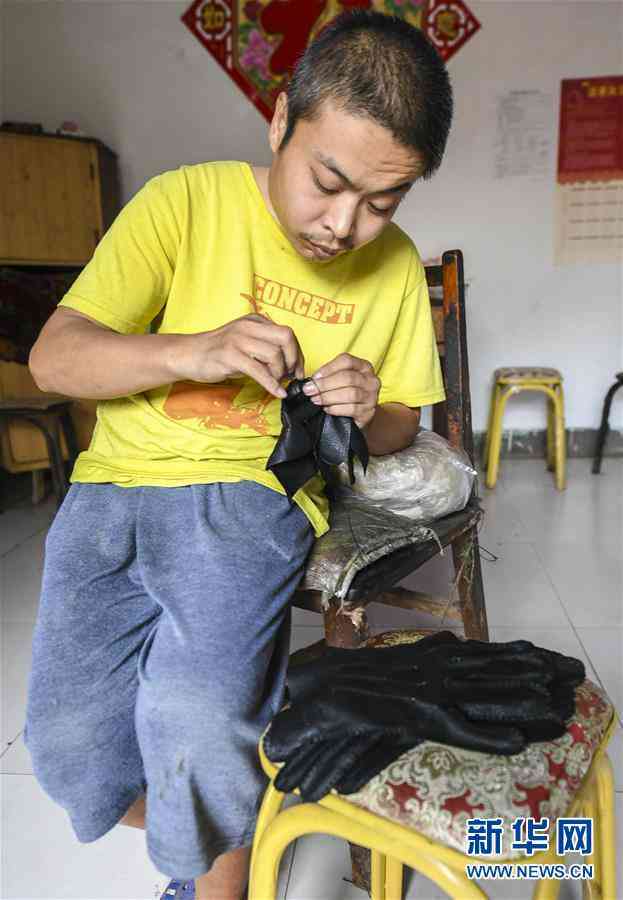 强直性脊柱炎能因公评残吗：如何申请残疾鉴定与评定标准