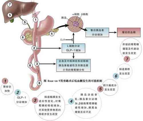 疟疾患者的寿命预期与治疗影响：深入了解疟疾对生命的影响