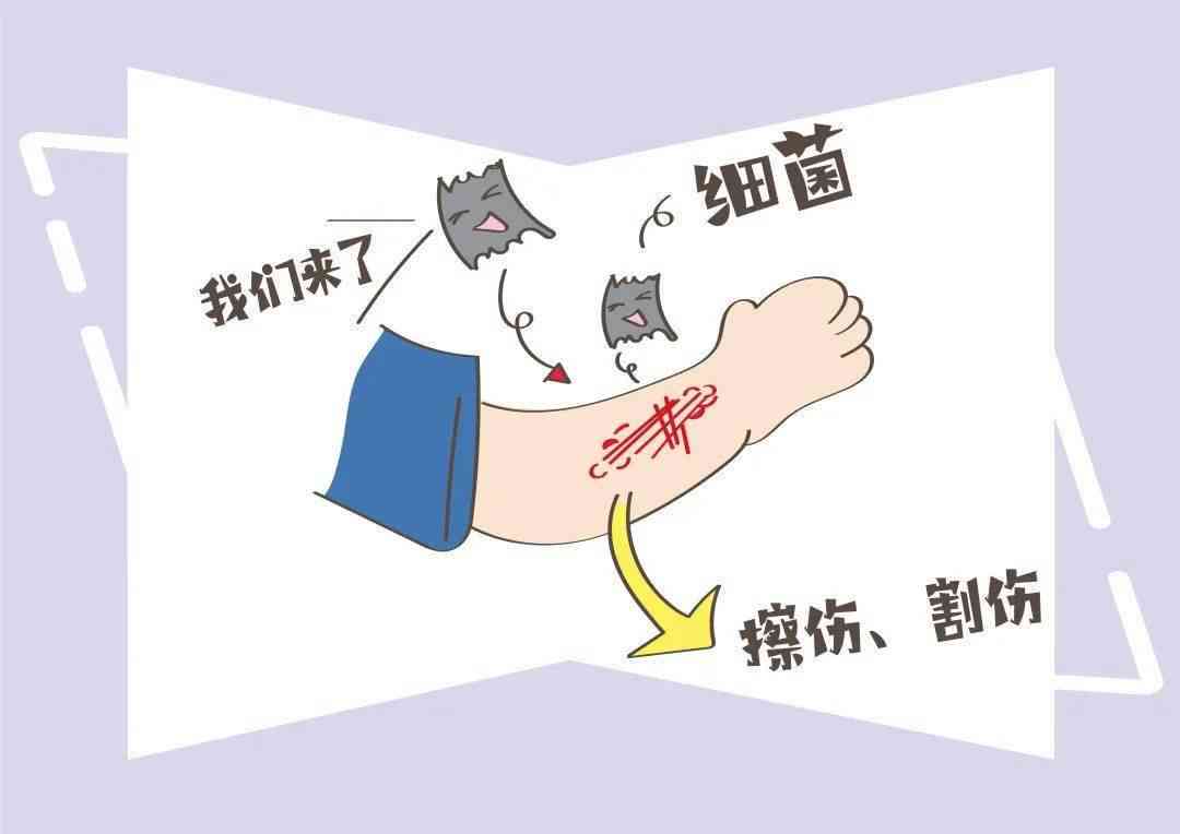 得了破伤风可以认定工伤吗怎么赔偿及治愈情况咨询医生