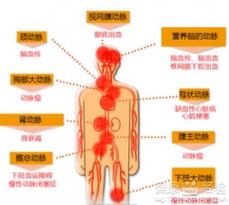 心境障碍可以有以下哪些表现：类型、特点及形成症状概述