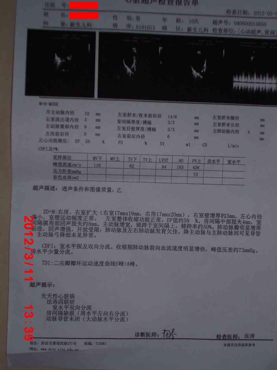 心脏支架手术是否属于工伤：工伤认定标准及常见疑问解答