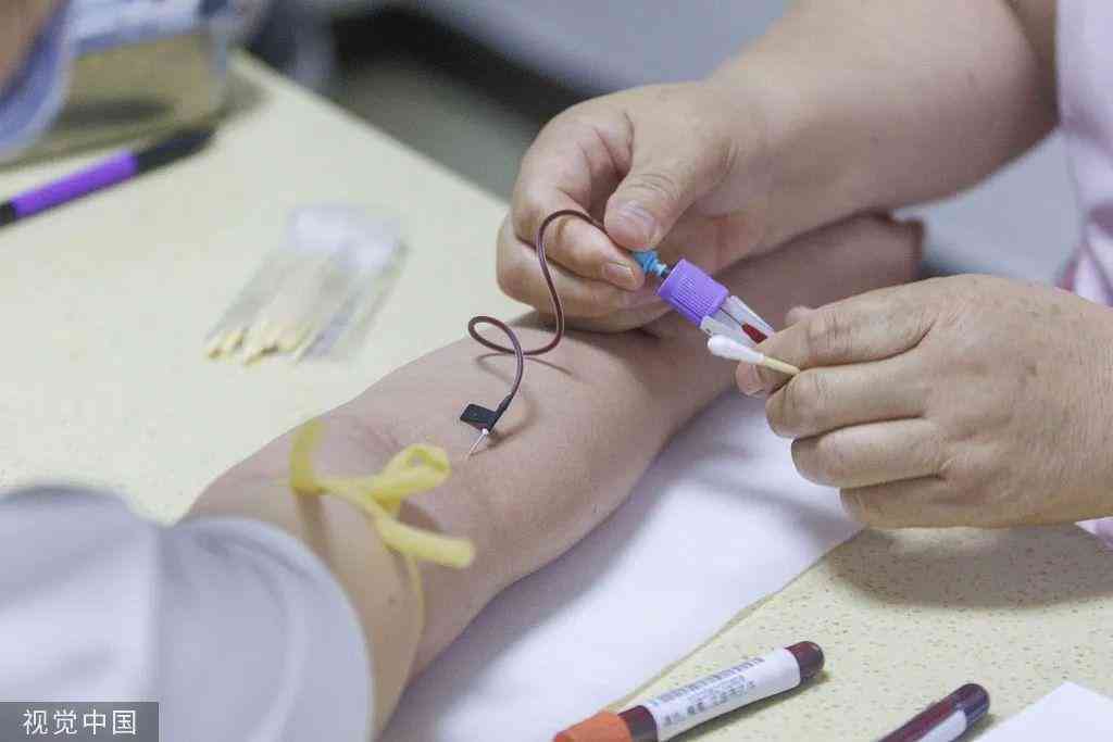 体检报告解读指南：全面分析各项指标意义与异常情况处理