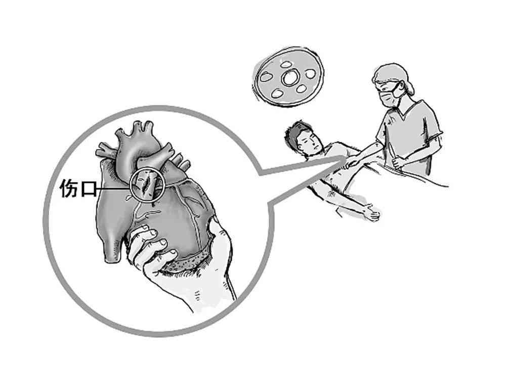 心脏过快能认定工伤事故吗