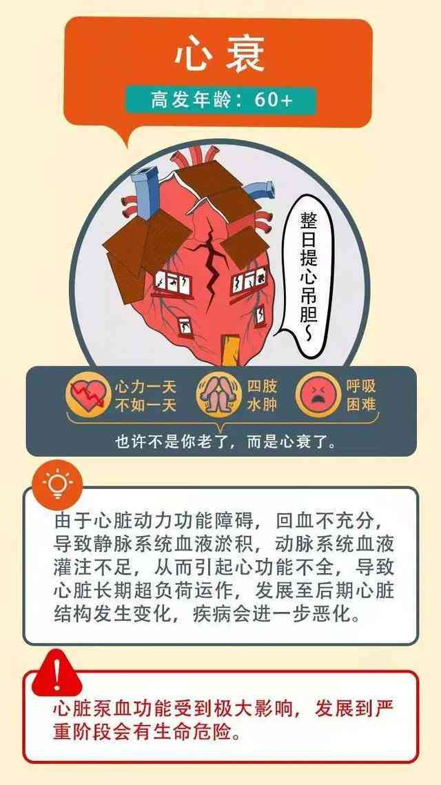急性心衰能认定工伤