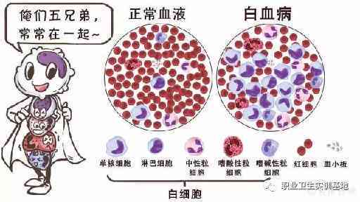 白细胞减少症患者的职场适应与工作能力评估